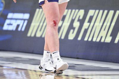 NCAA Women’s Basketball Tournament - Sweet Sixteen - Birmingham